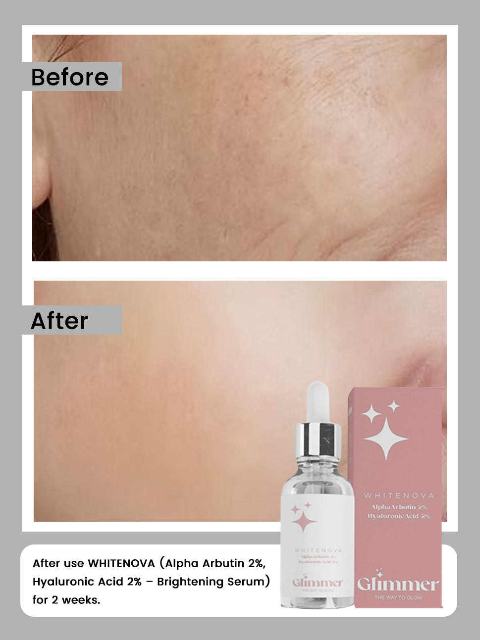 WHITENOVA (Alpha Arbutin 2%, Hyaluronic Acid 2% – Brightening Serum)