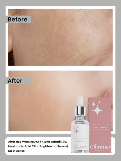 WHITENOVA (Alpha Arbutin 2%, Hyaluronic Acid 2% – Brightening Serum)