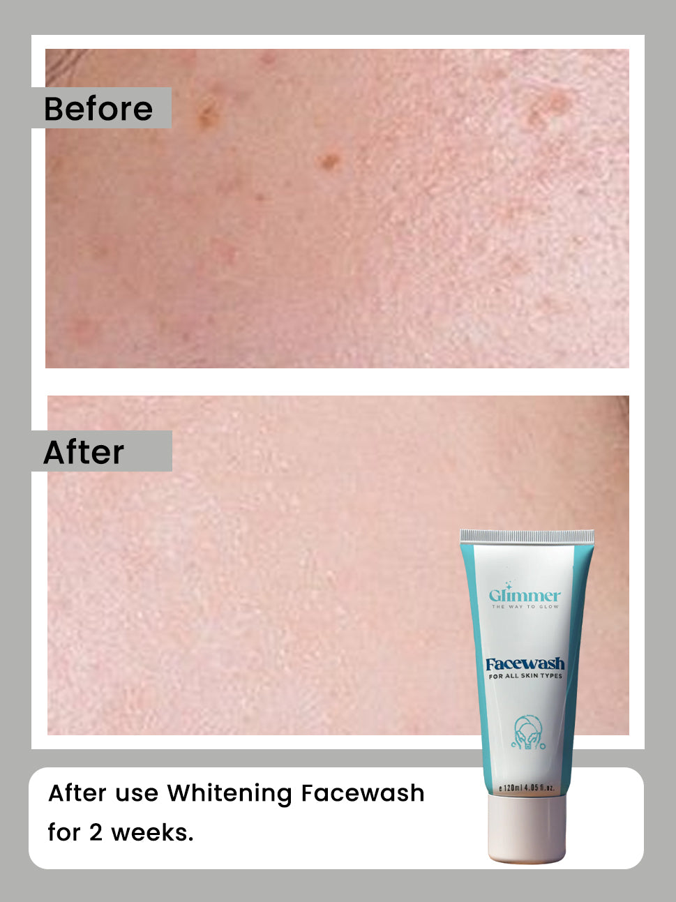 Whitening Facewash